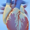 What is a Cardiac Cath? (MUMH)