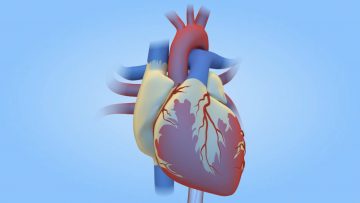 What is a Cardiac Cath? (MWHC)