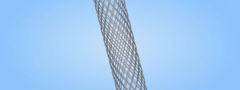 What is a Stent? (MWHC)